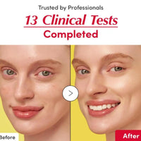 Vitamin C & Niacinamide Brightening Face Serum
